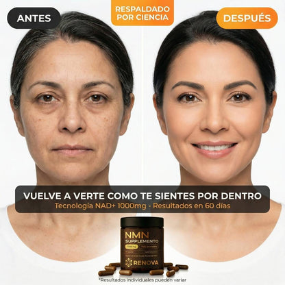 NMN+ Revive™ NAD Suplemento Anti-Edad